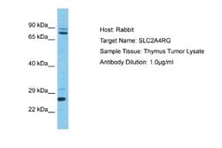 SLC2A4RG Antibody, Novus Biologicals 100 &mu;L | Buy Online | Novus Biologicals | Fisher Scientific